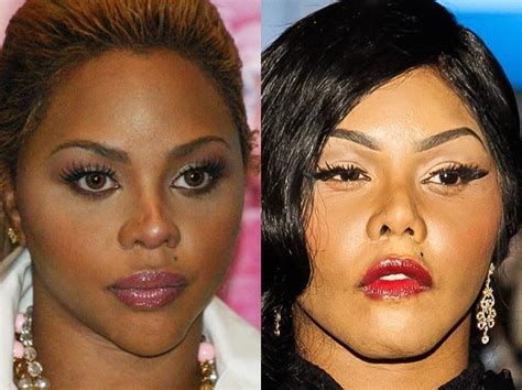 lil kim face surgery.